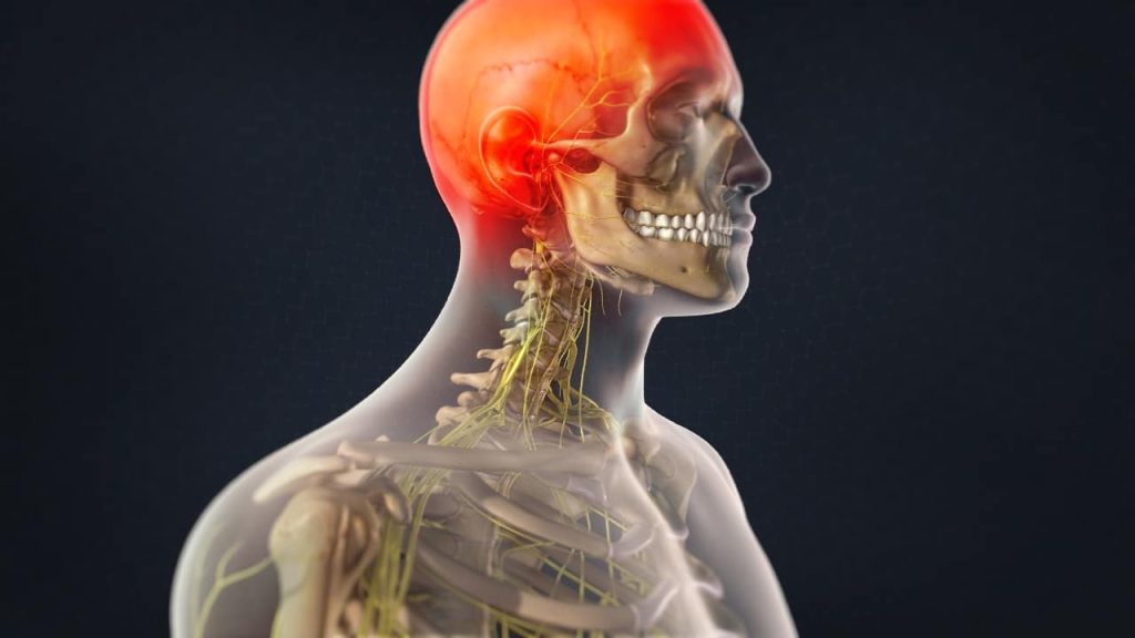 Occipital Nerve Block