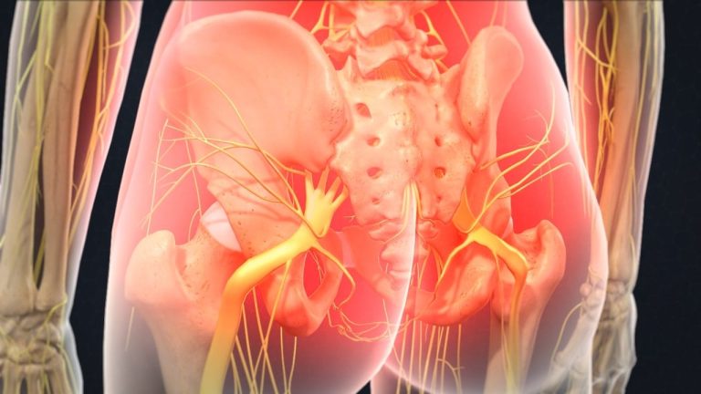 Sacroiliac Joint Block