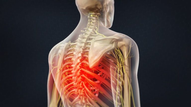 Thoracic Spinal Nerve Analgesia