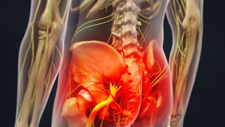Lumbar Spinal Nerve Analgesia