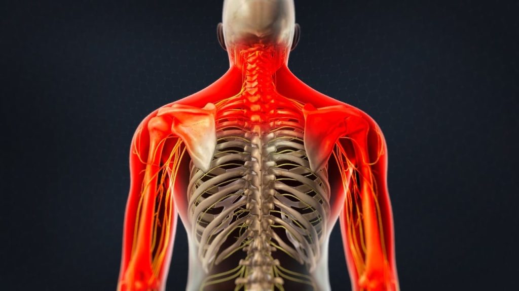 Cervical Spinal Nerve Analgesia