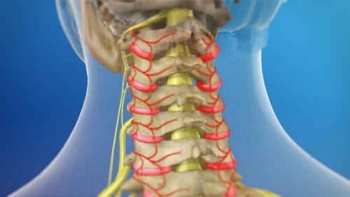 Pain in facet joints and cervical medial branch nerves