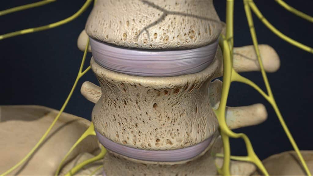 Поясничные позвонки и межпозвоночные диски