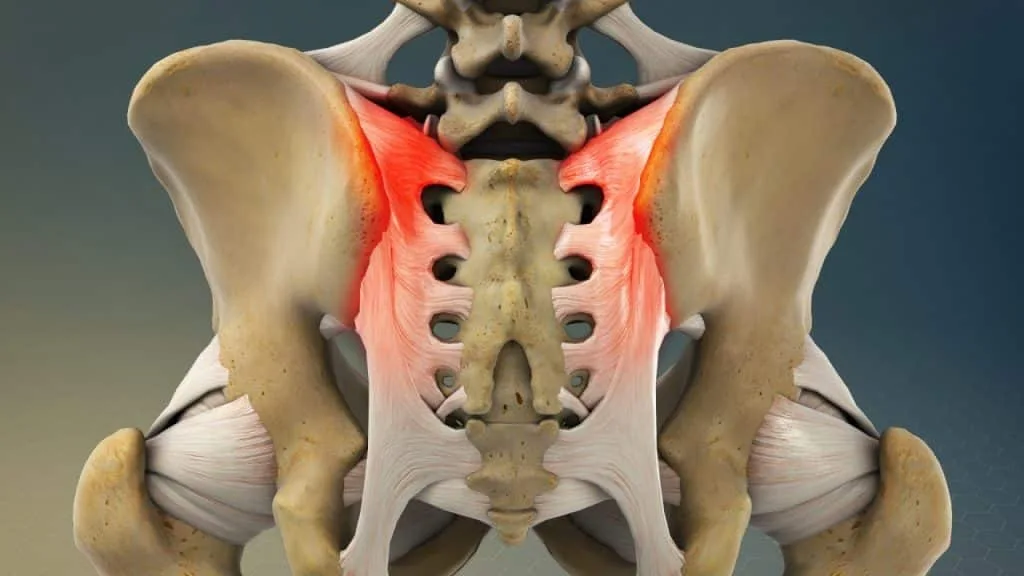 Sacroiliac joint pain (posterior view)
