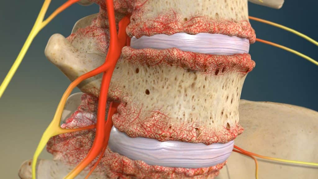 Поясничный отдел позвоночника с костными выступами