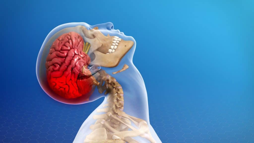 Schleudertrauma (Kopf nach hinten)