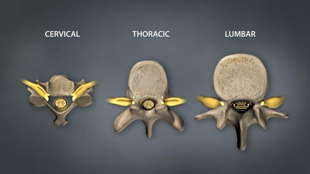 Typischer Wirbel und Rückenmark mit Nervenwurzeln, Darstellung im Foramen intervertebrale (Ansicht von oben)