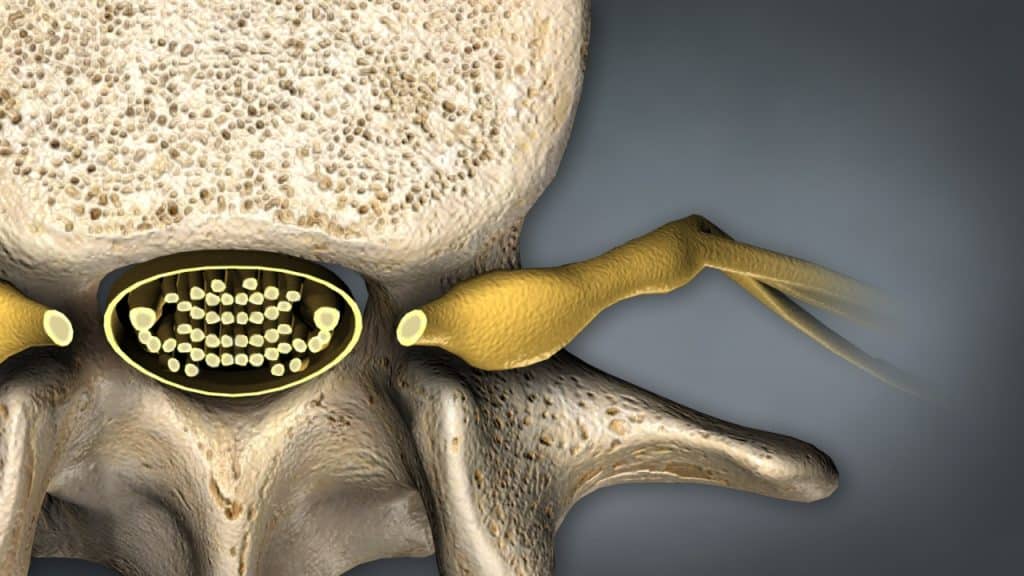 Nahansicht des Lendenwirbels mit Cauda equina und Nervenwurzeln (Ansicht von oben)