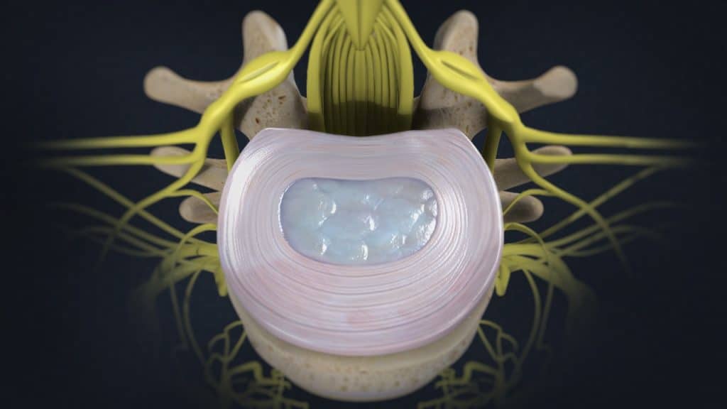 Gesunde lumbale Bandscheibe (Ansicht von oben)