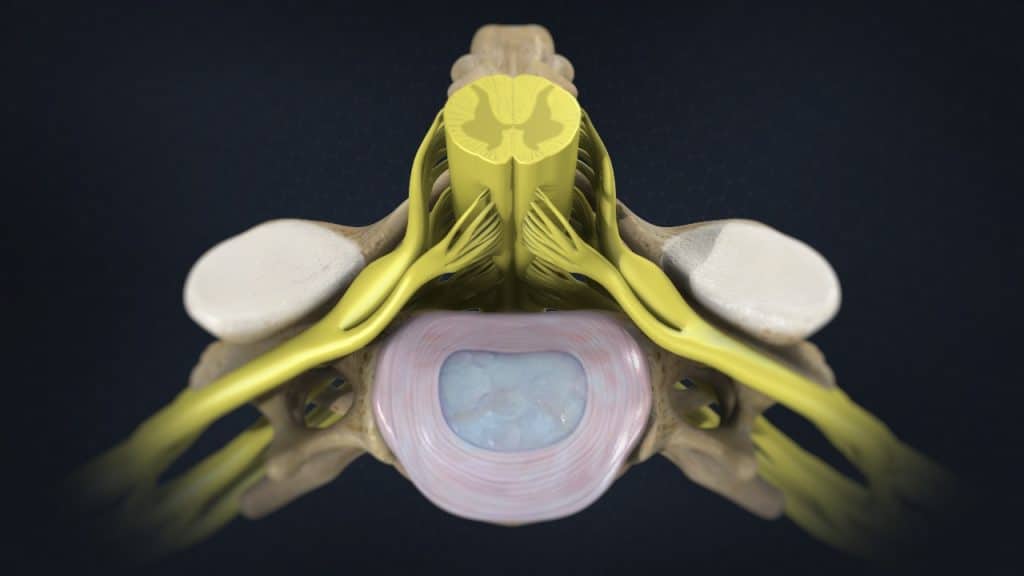 Gesunde Bandscheibe C5 und Anatomie des Nackens