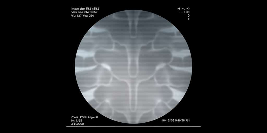Ακτινοσκοπική εικόνα της οσφυϊκής μοίρας