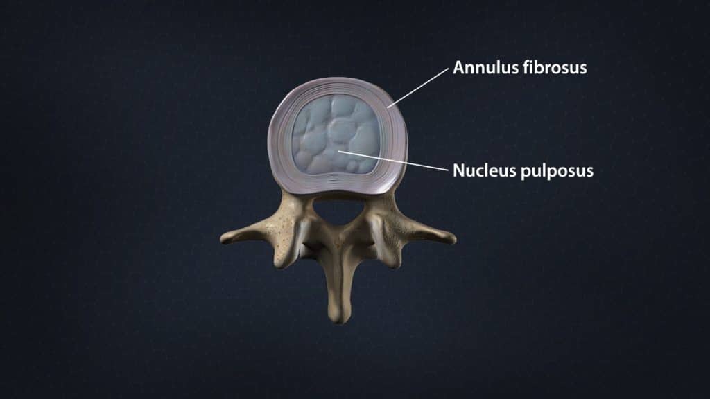 Intervertebral disc with annulus fibrosus and nucleus pulposus (superior view)