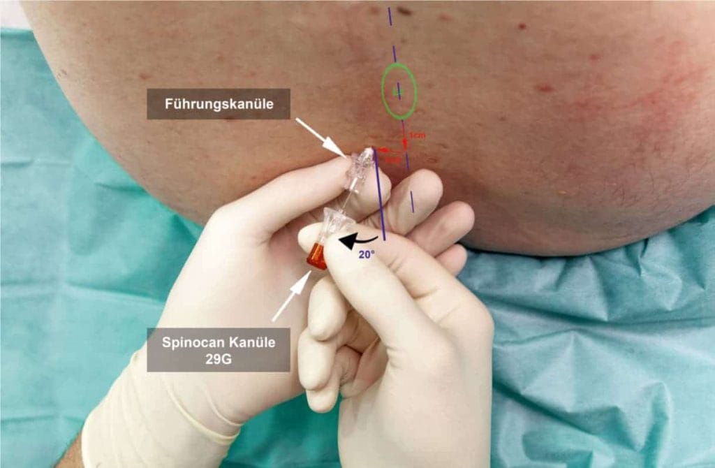 «Σεμινάριο Επεμβατικών Θεραπειών στη Σπονδυλική Στήλη»Bochum, 8 - 9 Οκτωβρίου 2021