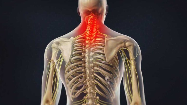 Neck Pain