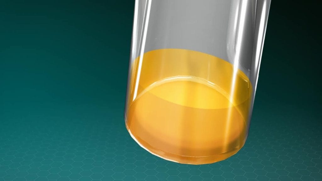 Platelet-rich plasma (PRP) therapy