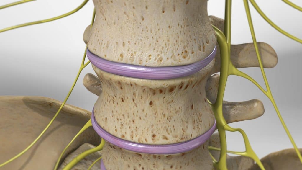 Коллапс поясничного диска