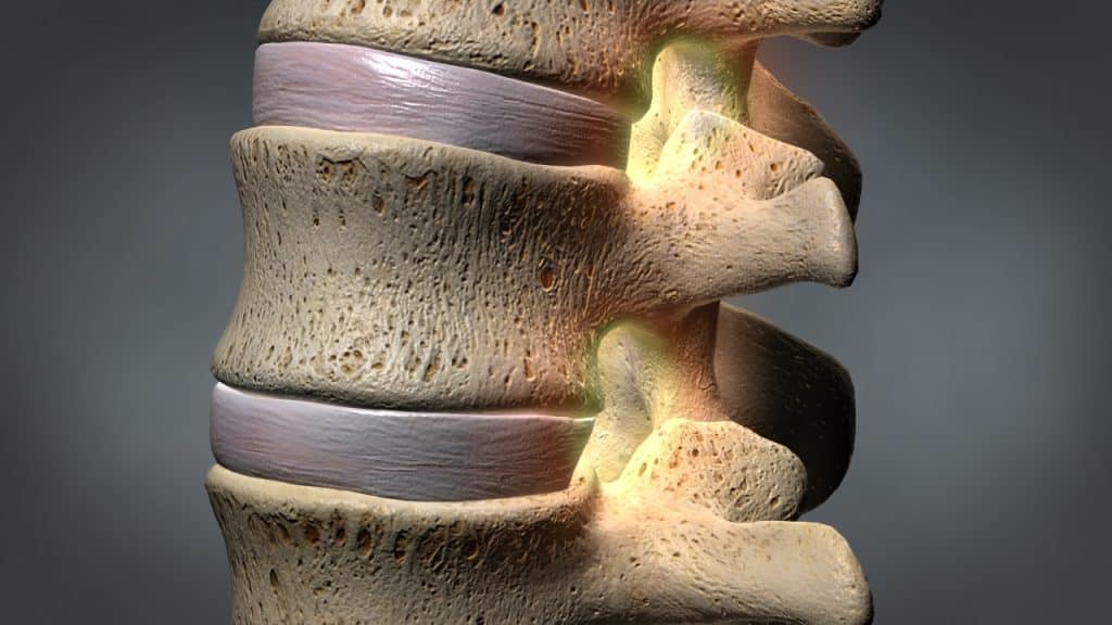 Nahansicht der Lendenwirbelsäule, leuchtende Foramina intervertebralia (3/4 Vorderansicht)