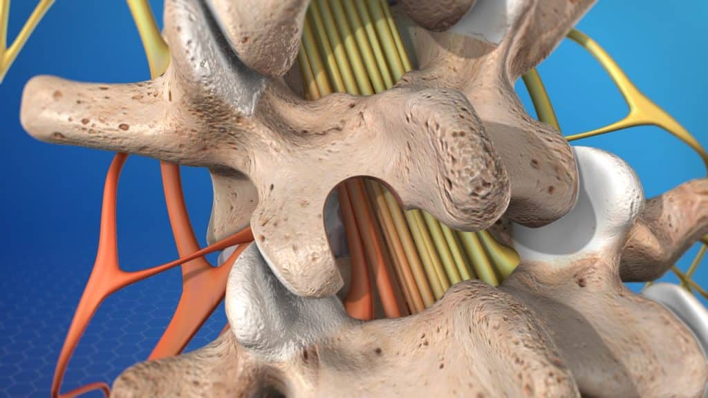 Lumbar disc microsurgery (Laminectomy)
